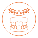 Mechanical Trauma Mouth Ulcers Mechanical Trauma Mouth Ulcers